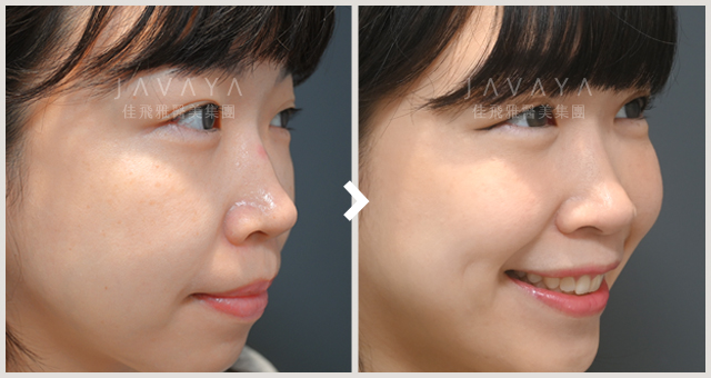 佳飛雅緻美學診間